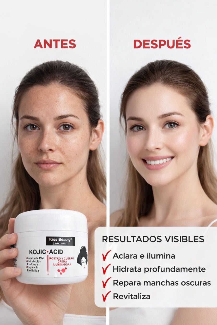 Crema Iluminadora con Ácido Kójico para Rostro y Cuerpo
